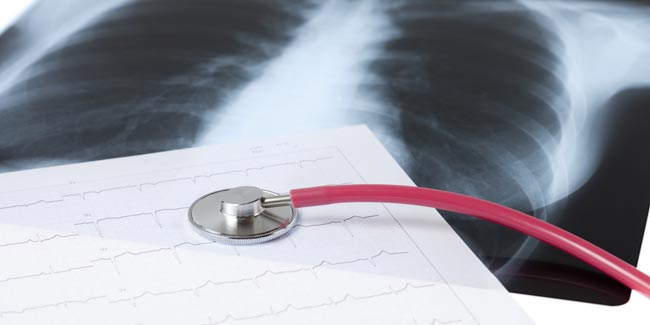 Increased BMI Causes Heart Failure